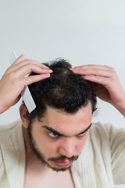 closeup of a male looking in the mirror at his receding hair